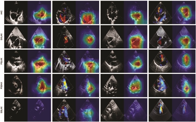 Image: CAM figures of testing images (Photo courtesy of SPJ; DOI:10.34133/research.0319)
